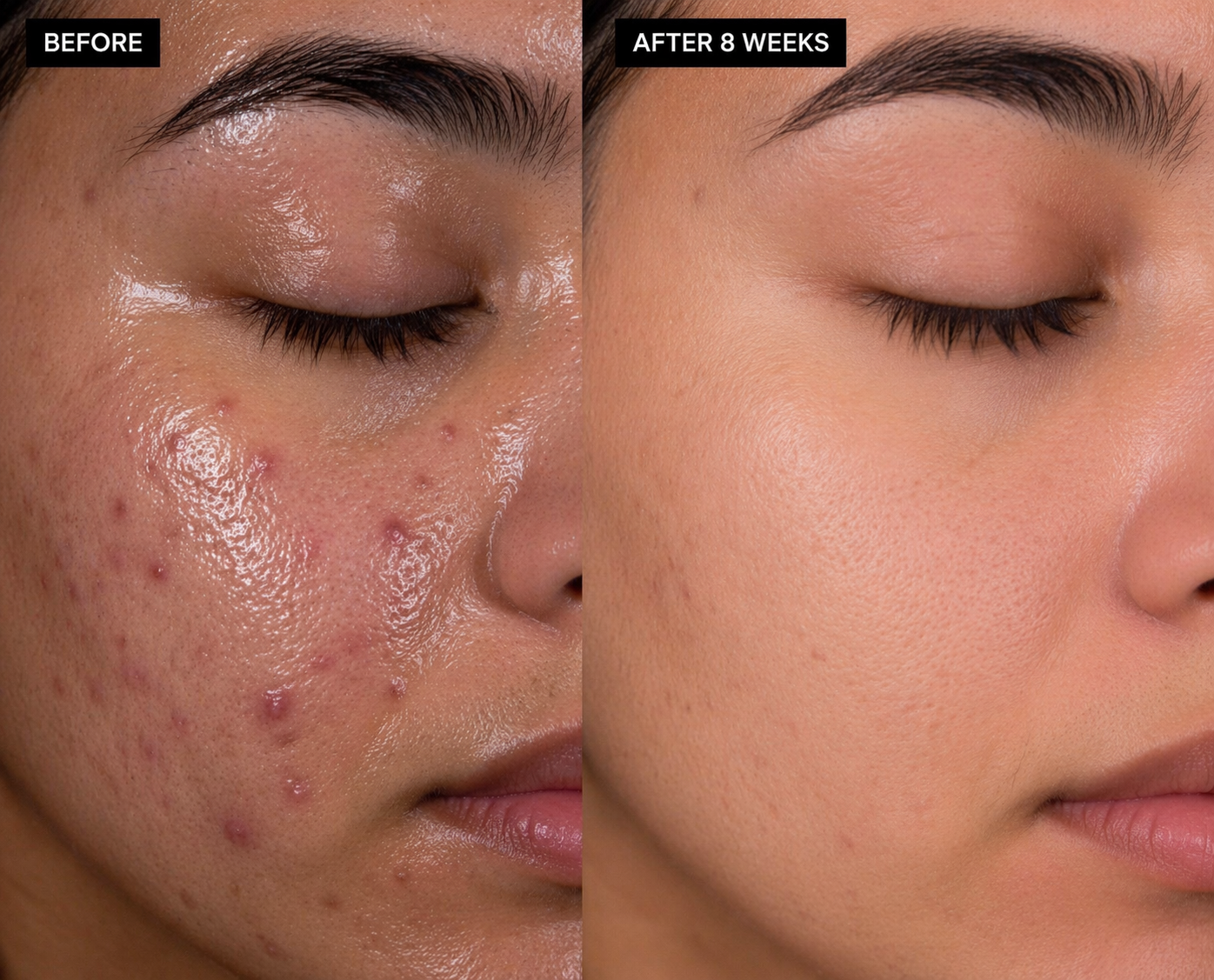 Clarifying Niacinamide